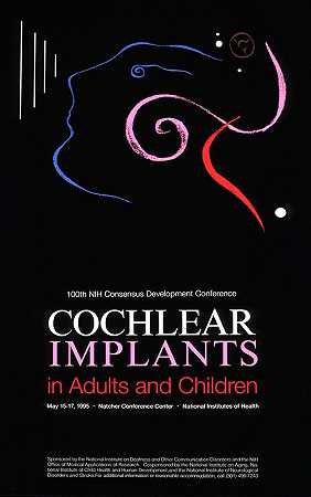 成人和儿童的人工耳蜗植入`Cochlear implants in adults and children (1995) by National Institutes of Health