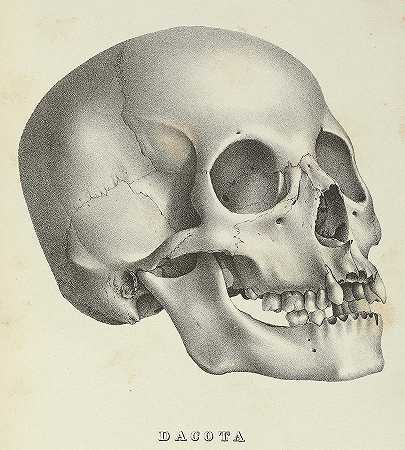 美国鹤，达科他州`Crania Americana, Skull Dacota by Samuel George Morton