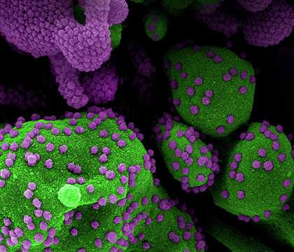 新型冠状病毒2019冠状病毒疾病病毒9型`COVID-19, Novel Coronavirus SARS-CoV-2, Image No.9 by National Institute of Allergy and Infectious Diseases