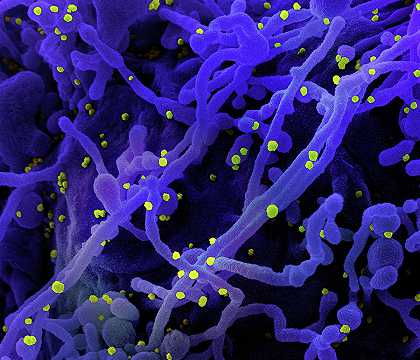 新型冠状病毒2019冠状病毒疾病病毒12型`COVID-19, Novel Coronavirus SARS-CoV-2, Image No.12 by National Institute of Allergy and Infectious Diseases