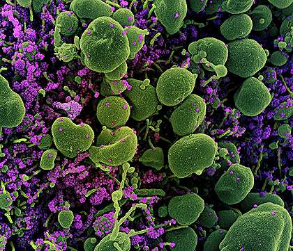 C2019冠状病毒疾病新型冠状病毒`COVID-19, Novel Coronavirus SARS-CoV-2, Image No.10 by National Institute of Allergy and Infectious Diseases