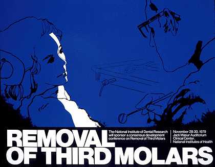 第三磨牙拔除术`Removal of third molars (1979) by National Institutes of Health