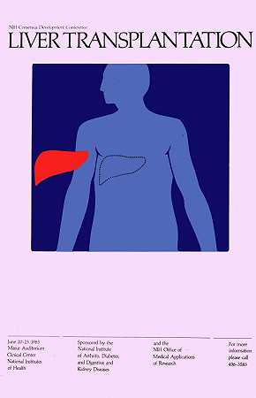 肝移植`Liver transplantation (1983) by National Institutes of Health