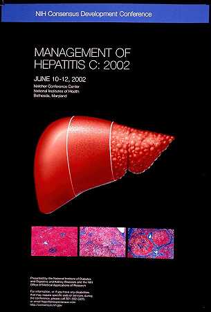 丙型肝炎的管理`Management of hepatitis C (2002) by National Institutes of Health